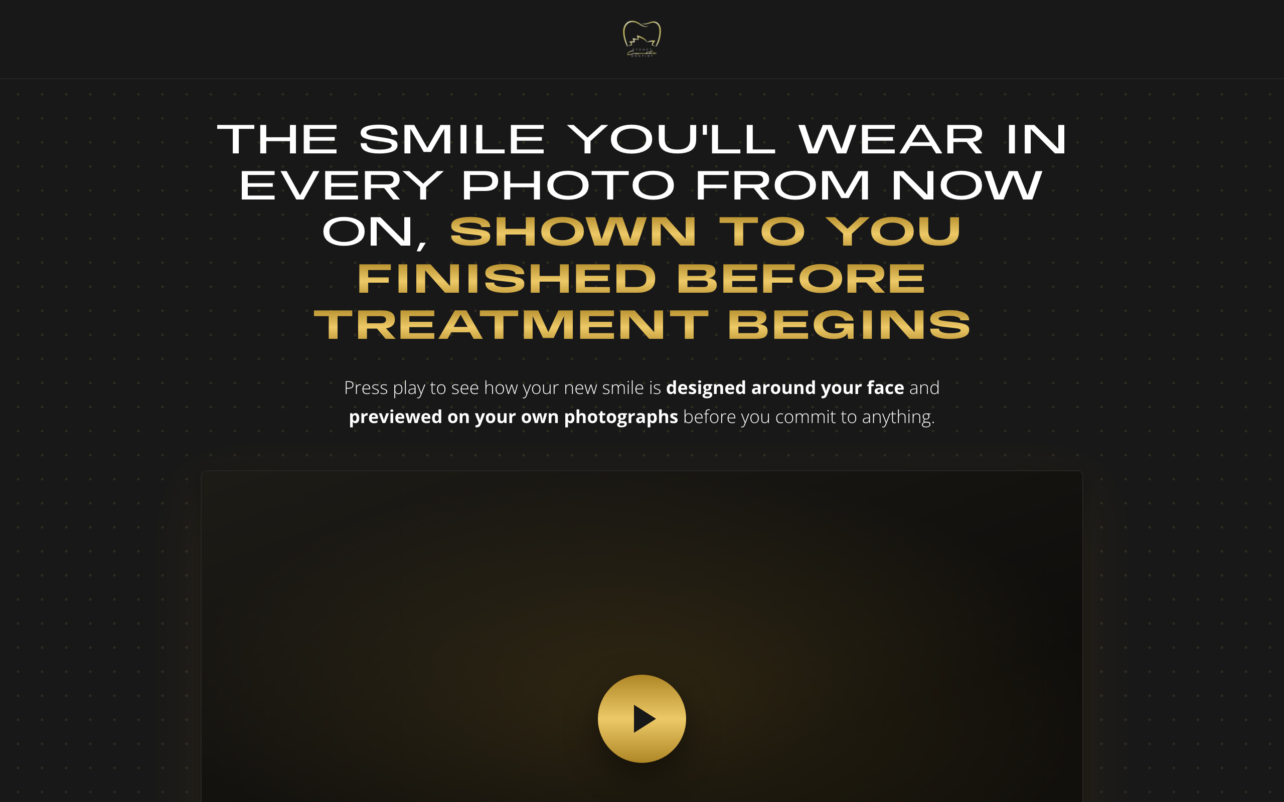 Landing page preview